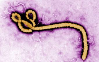 Ebola-virus-colour_2990742k